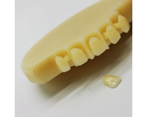 Multilayer PMMA — OP/98mm/14mm-20mm
