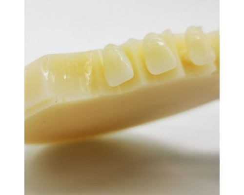 Multilayer PMMA — OP/98mm/14mm-20mm