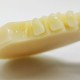 Multilayer PMMA — OP/98mm/14mm-20mm